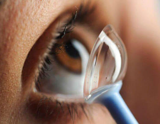 Putting on scleral lenses into eye