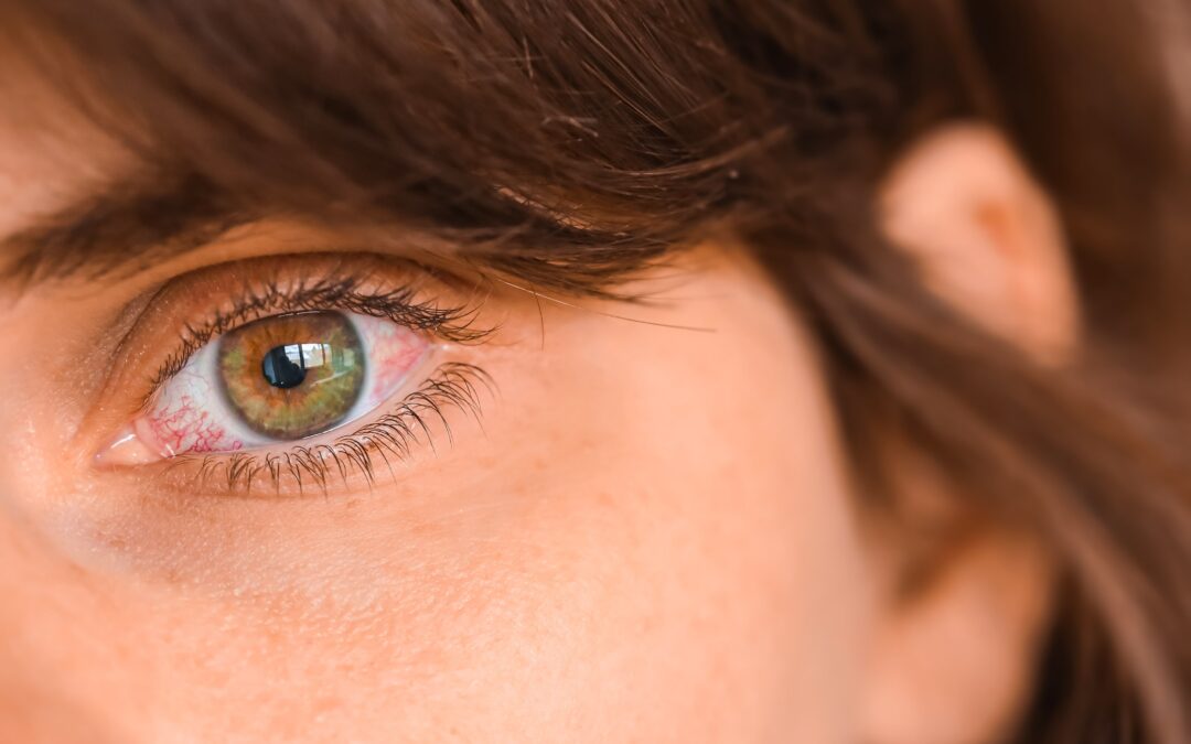 The Two Types of Dry Eye — and Why You Might Have Both