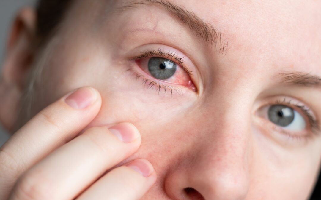 Why Does It Feel Like There’s Something in My Eye — When There’s Nothing There?